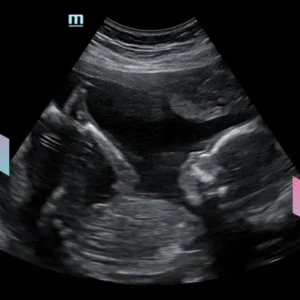 Scan Video